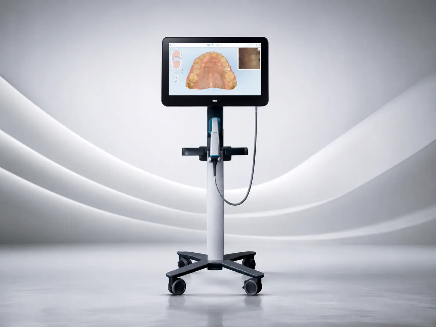 Digital intraoral scan displayed in a dental clinic